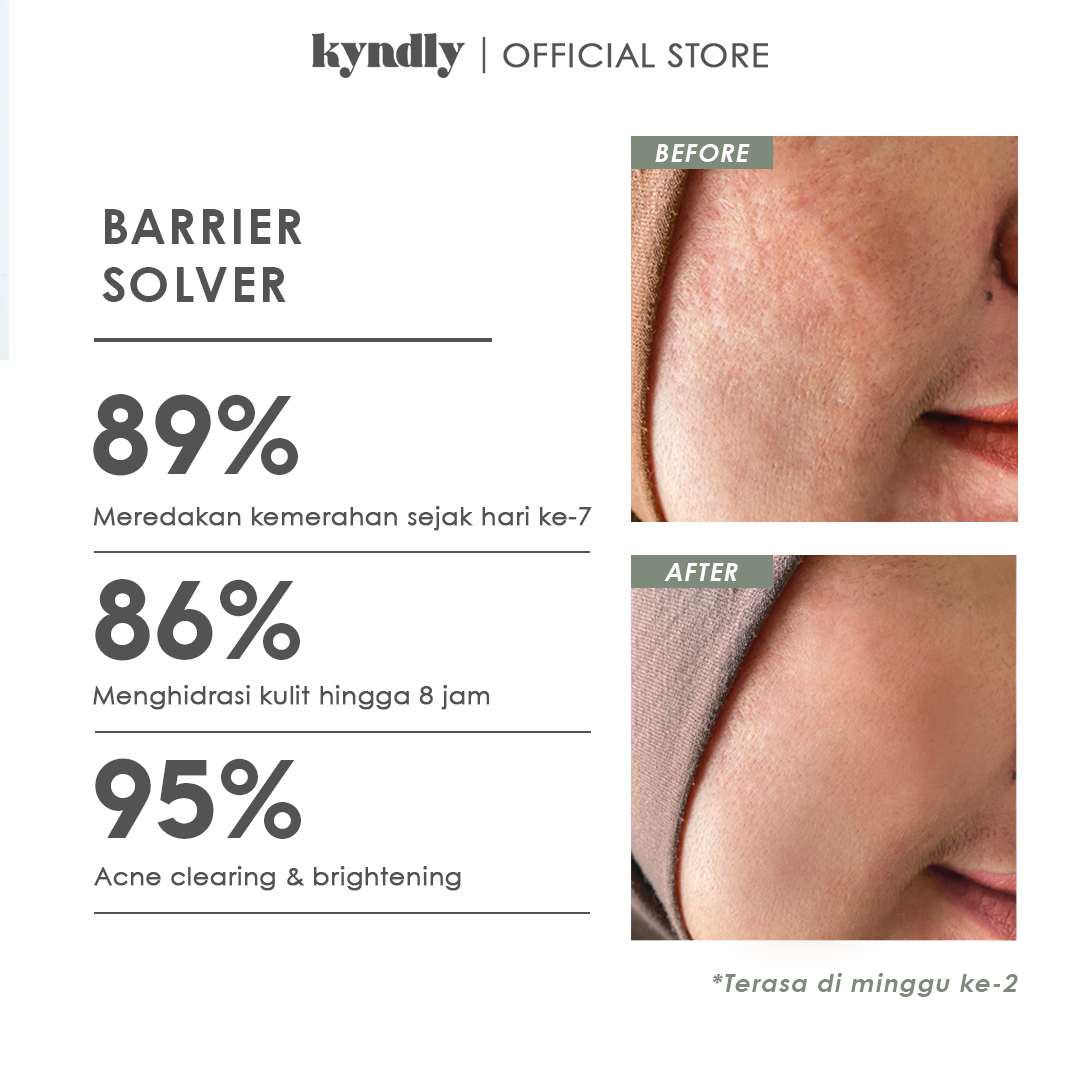 KYNDLY MATCHA SLIME Moisturizer - Image 10