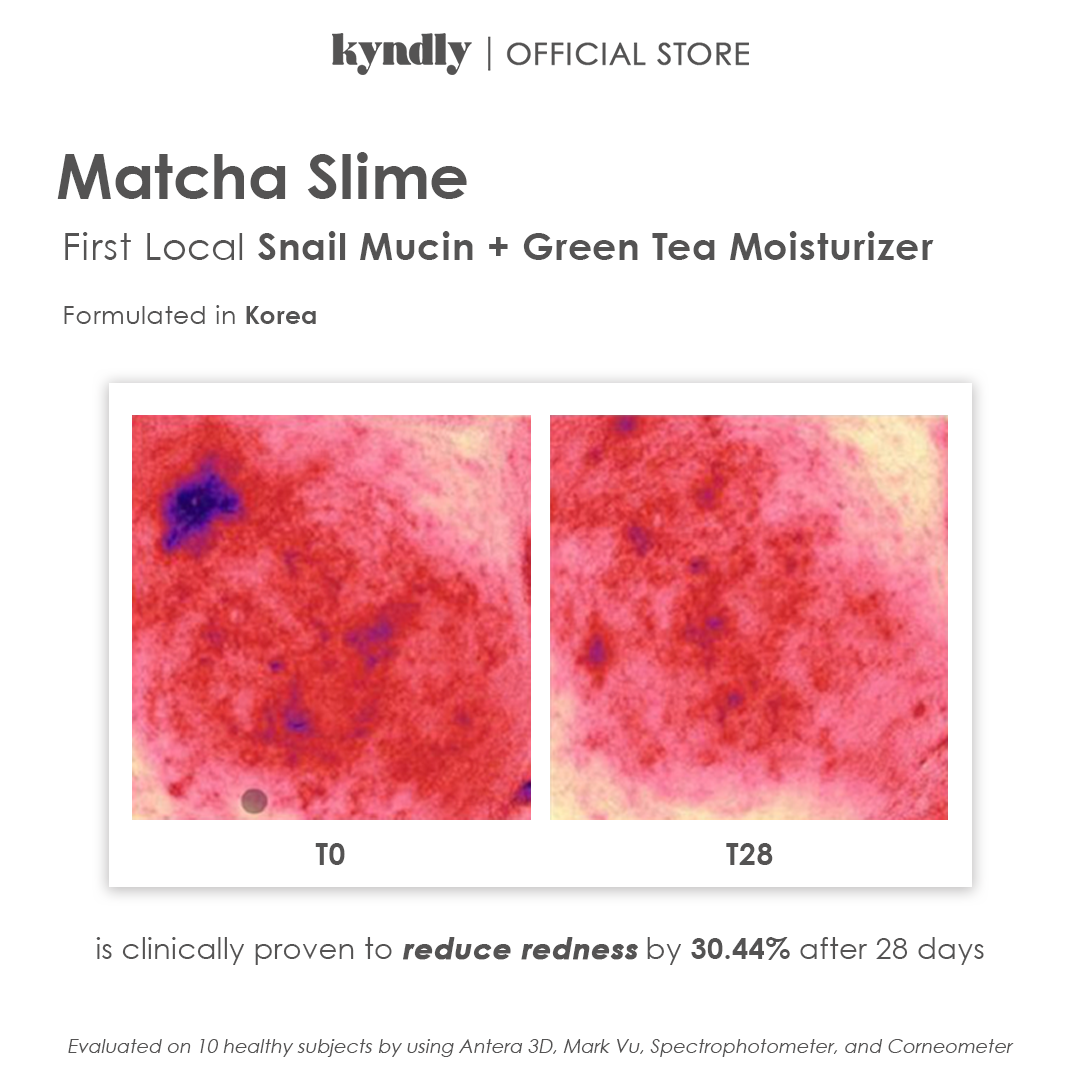 KYNDLY MATCHA SLIME Moisturizer - Image 7