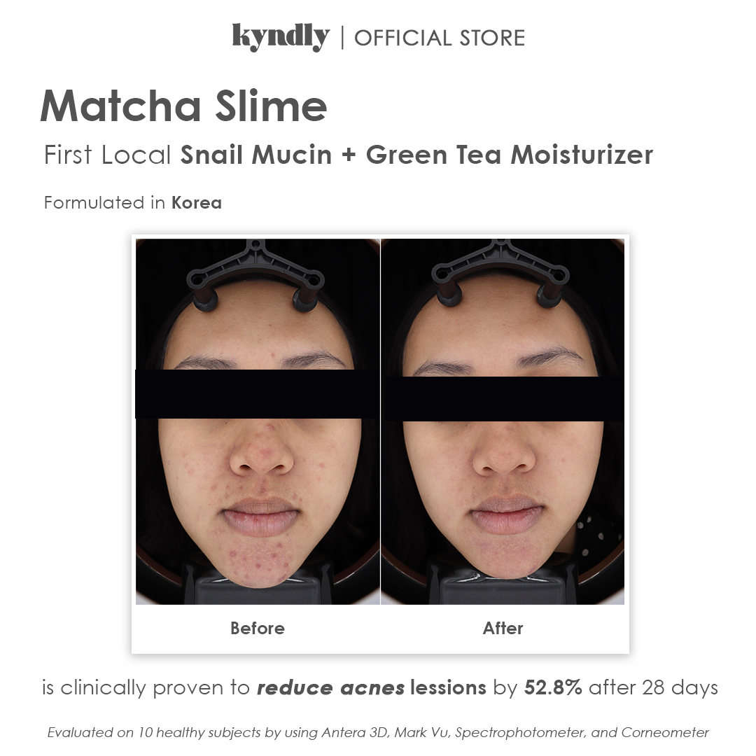 KYNDLY MATCHA SLIME Moisturizer - Image 9